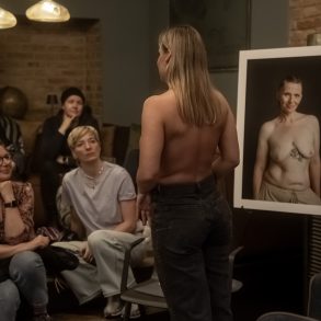 Eine Frau zeigt ihre Brustkrebsnarbe. Rundherum stehen Bilder von Frauen, die ihre Narben fotografieren ließen.